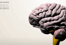 복합부위통증증후군, 생로병사